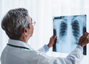 x rays vs digital motion x ray