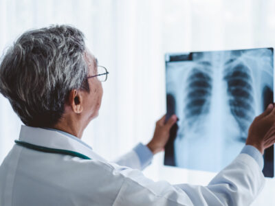 x rays vs digital motion x ray