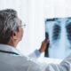 x rays vs digital motion x ray